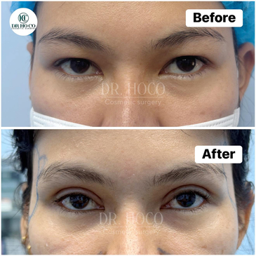 Slider image (7) Dr. Ho Co - Aesthetics and Plastic Surgery in Vietnam